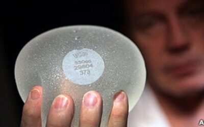 ¿Quién es Responsable por las Prótesis Defectuosas?